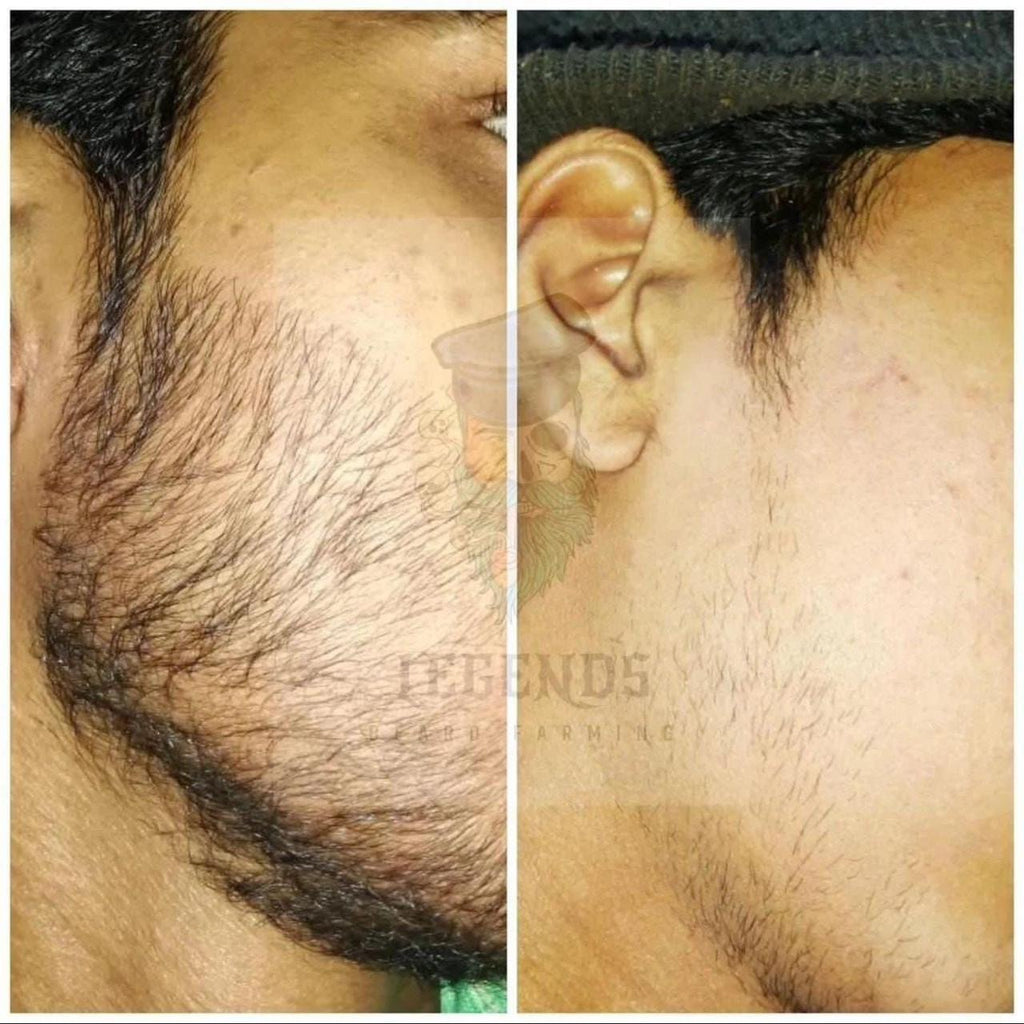 Beard Serum