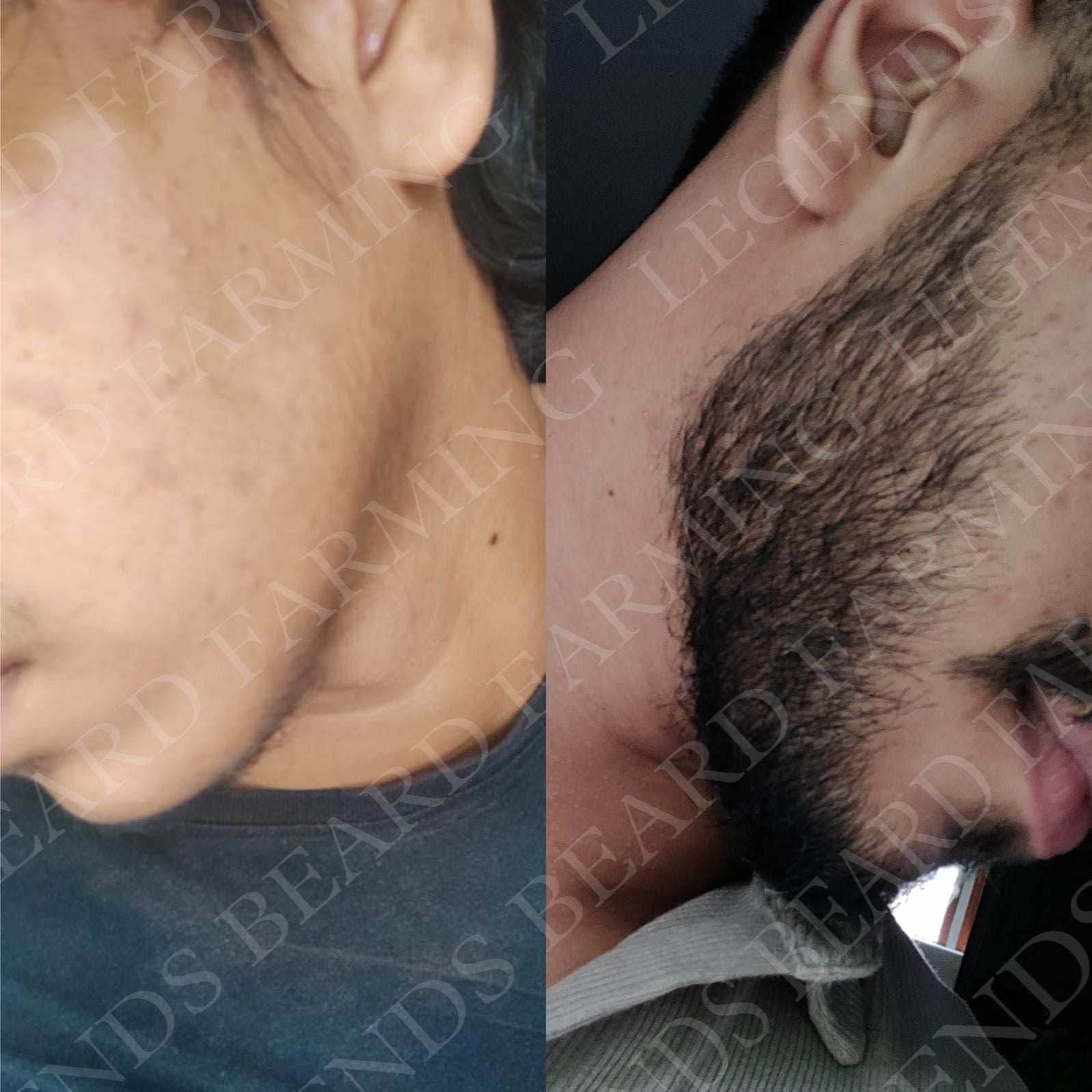 Beard Serum