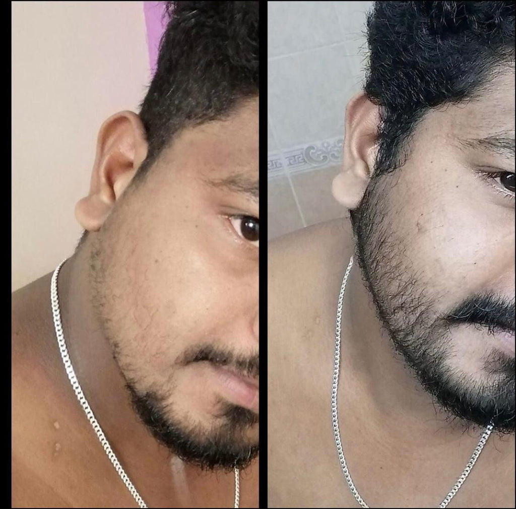 Beard Serum