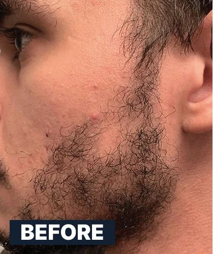 Beard Serum — Before use