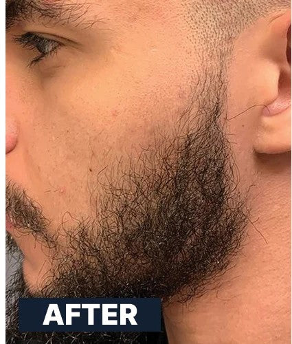 Beard Serum — After use