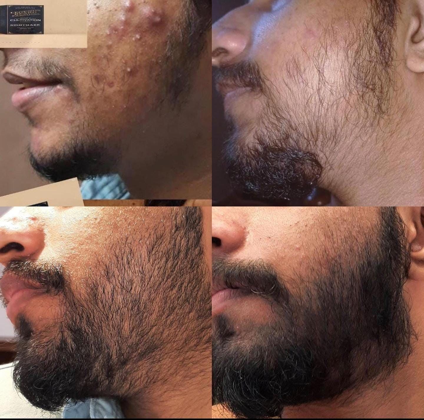 Beard Serum