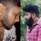 Beard Serum