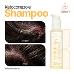 Anti-Dandruff Shampoo